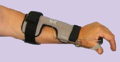 Improves R. O. M. at wrist, post fracture, radial palsy. Easy to shape aluminum frame for custome fit. Coiled spring at wrist produces dynamic wrist palmer arch, removable thumb outrigger. Breathable, removable liner. Optional wrist strap included.